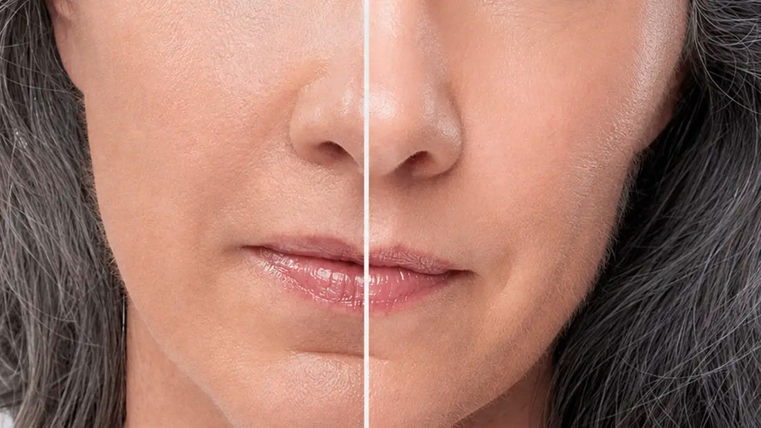 Skincare for Dry Skin: A Korean Routine to Restore Lasting Hydration