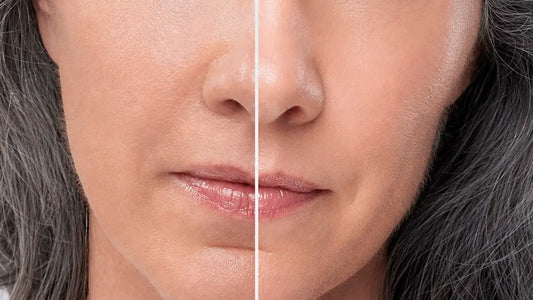 Skincare for Dry Skin: A Korean Routine to Restore Lasting Hydration