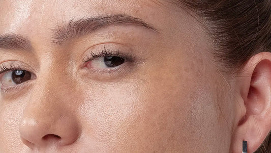 Toner Pads with Salicylic Acid: The Korean Solution for Textured Skin and Open Pores