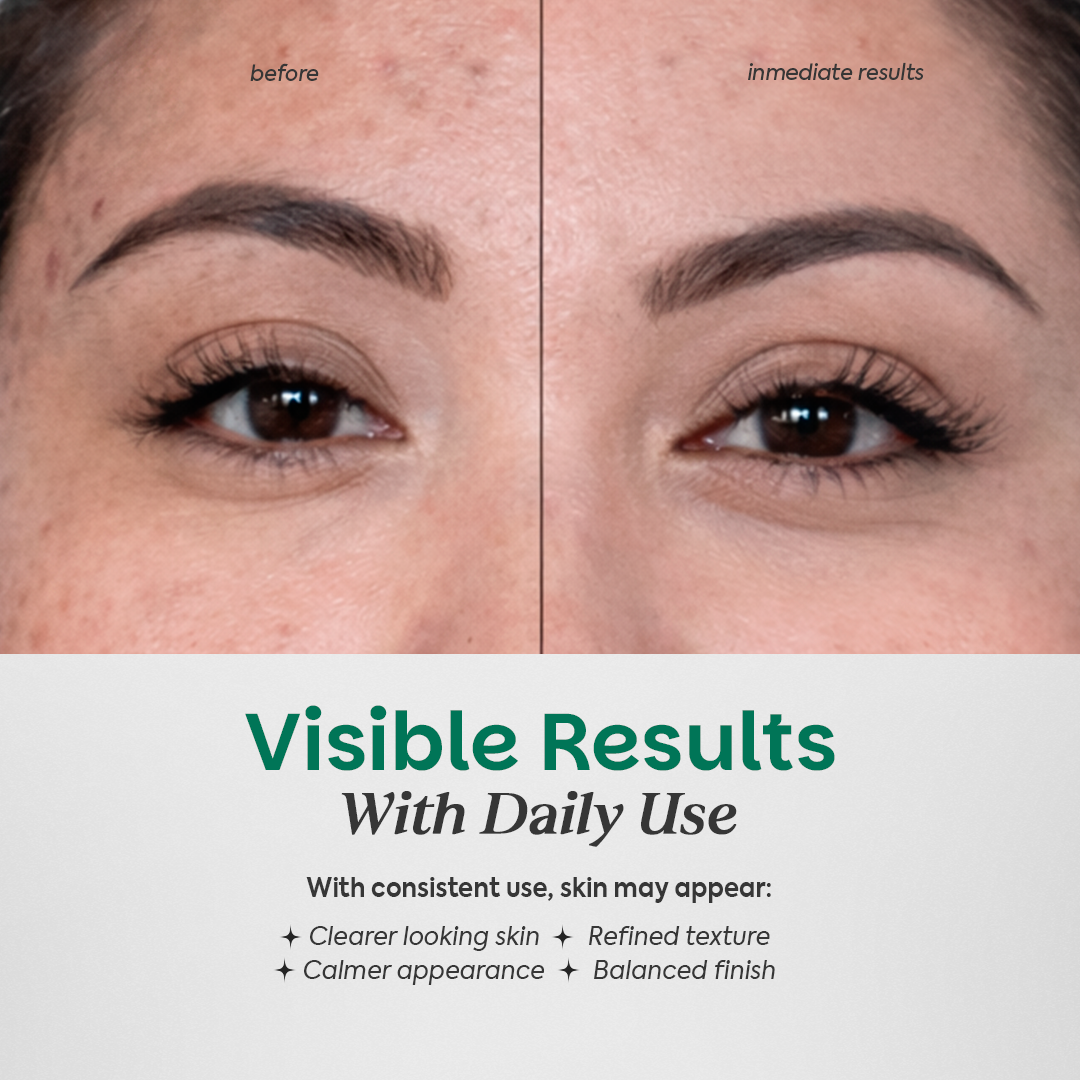 Dotless
